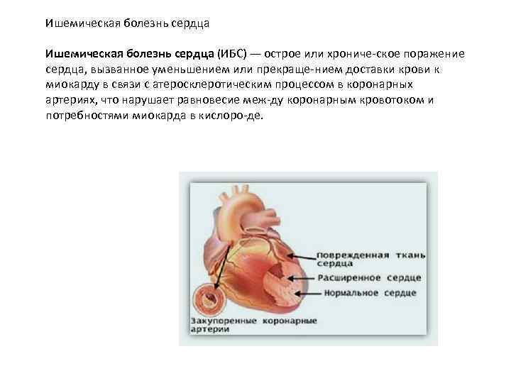 Ишемическая болезнь сердца (ИБС) — острое или хрониче ское поражение сердца, вызванное уменьшением или