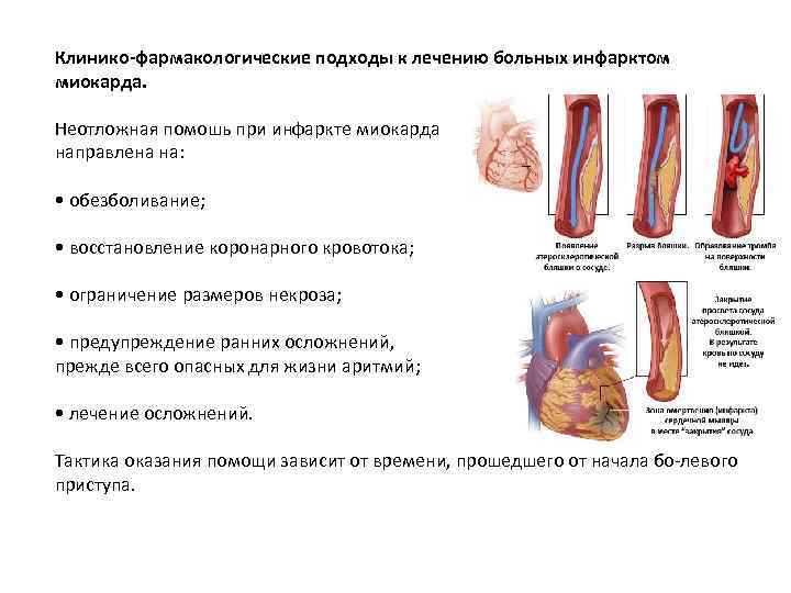 Клинико-фармакологические подходы к лечению больных инфарктом миокарда. Неотложная помошь при инфаркте миокарда направлена на: