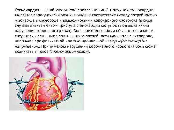 Болезнь тургенева грудная жаба. Причины стенокардии. Гемодинамика при стенокардии. Гемодинамическая стенокардия причины. Самая частая стенокардия.