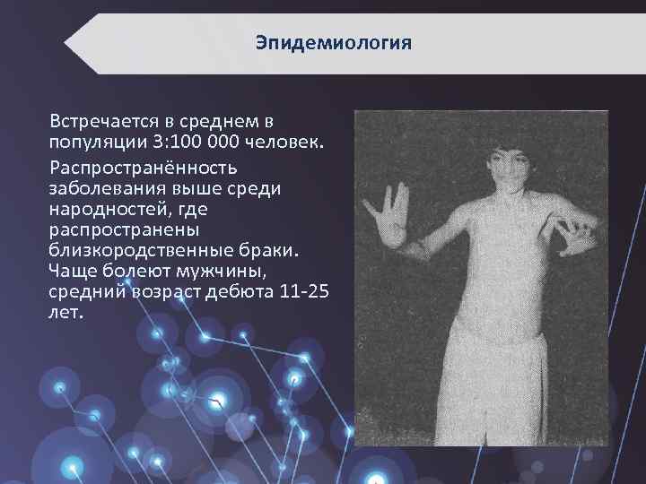 Эпидемиология Встречается в среднем в популяции 3: 100 000 человек. Распространённость заболевания выше среди