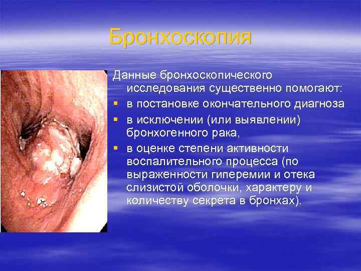 Бронхоскопия Данные бронхоскопического исследования существенно помогают: § в постановке окончательного диагноза § в исключении