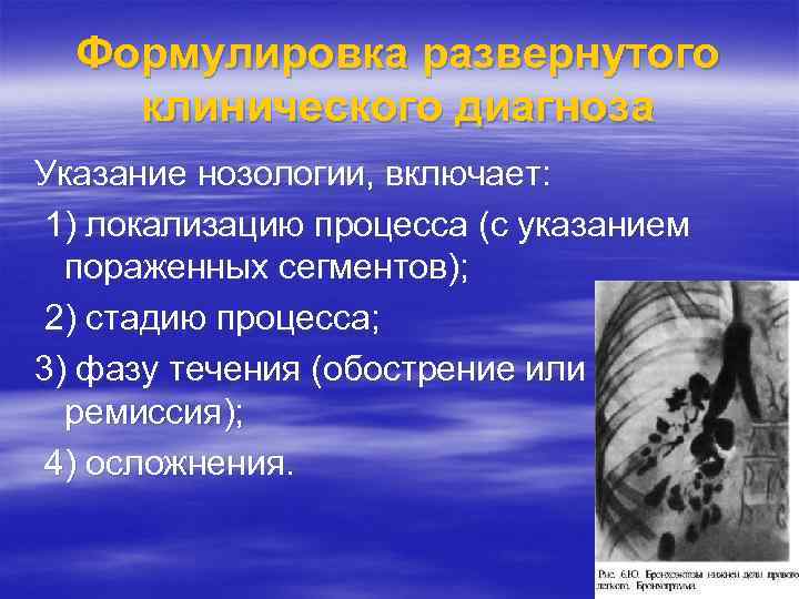 Формулировка развернутого клинического диагноза Указание нозологии, включает: 1) локализацию процесса (с указанием пораженных сегментов);