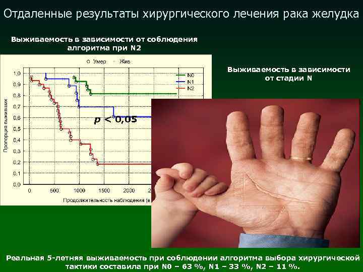 Отдаленные результаты хирургического лечения рака желудка Выживаемость в зависимости от соблюдения алгоритма при N