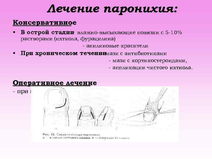 Лечение паронихия: Консервативное • В острой стадии влажно-высыхающие повязки с 5 -10% - растворами