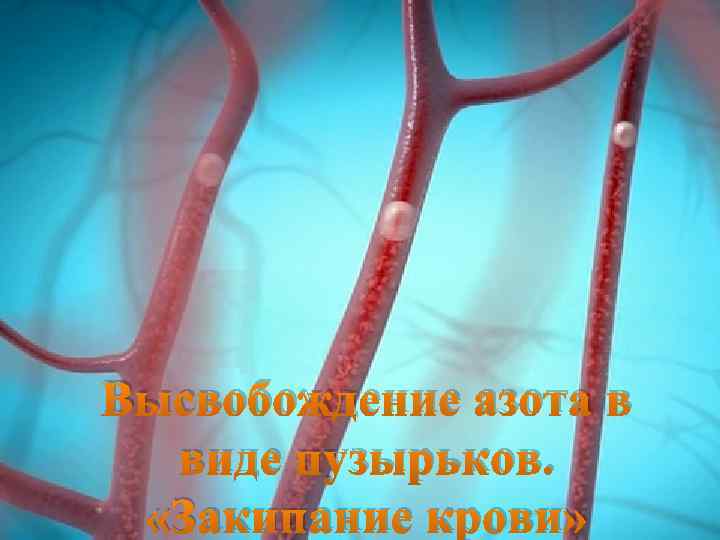  Высвобождение азота в виде пузырьков. «Закипание крови» 