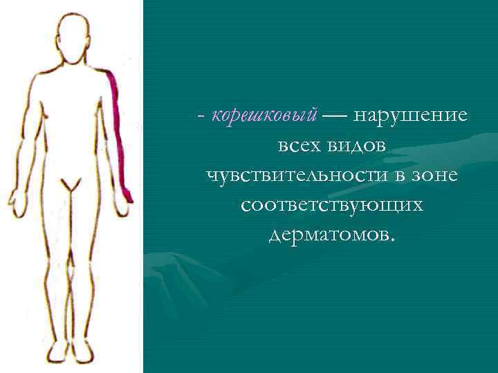 - корешковый — нарушение всех видов чувствительности в зоне соответствующих дерматомов. 