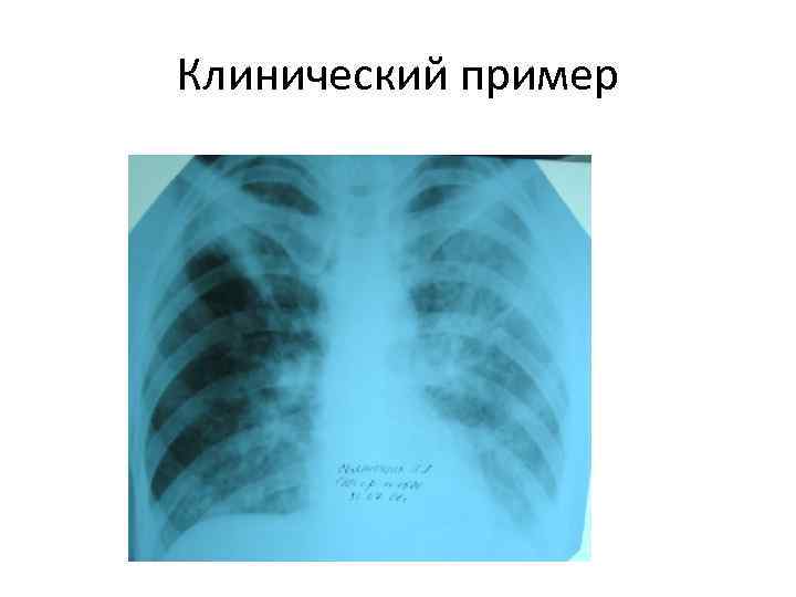 Клинический пример 