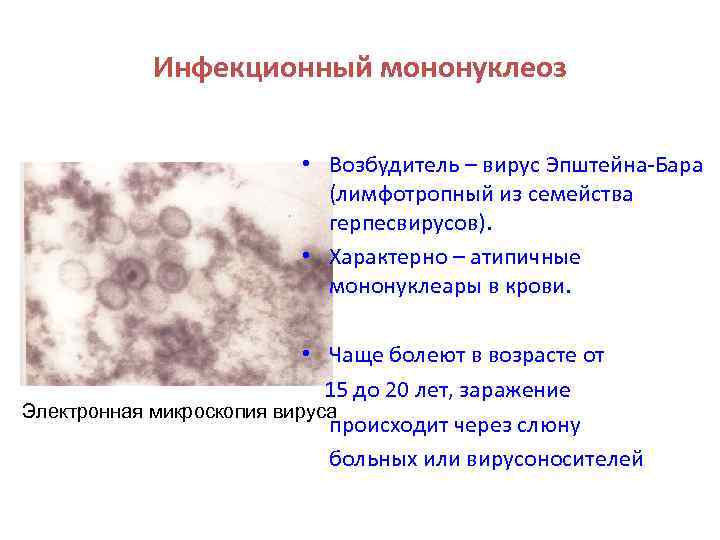 Мононуклеоз вирус эпштейна. Эпштейн Барра мононуклеоз противовирусные. Вирус Эпштейн Барра сыпь. Эпштейн Барр экзантема.