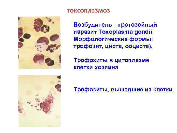 токсоплазмоз Возбудитель - протозойный паразит Toxoplasma gondii. Морфологические формы: трофозит, циста, ооциста). Трофозиты в