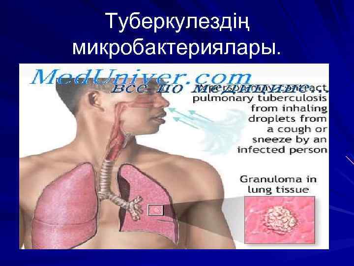 Туберкулездің микробактериялары. 