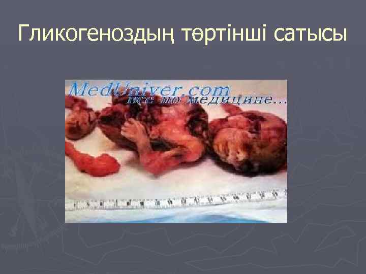 Гликогеноздың төртінші сатысы 