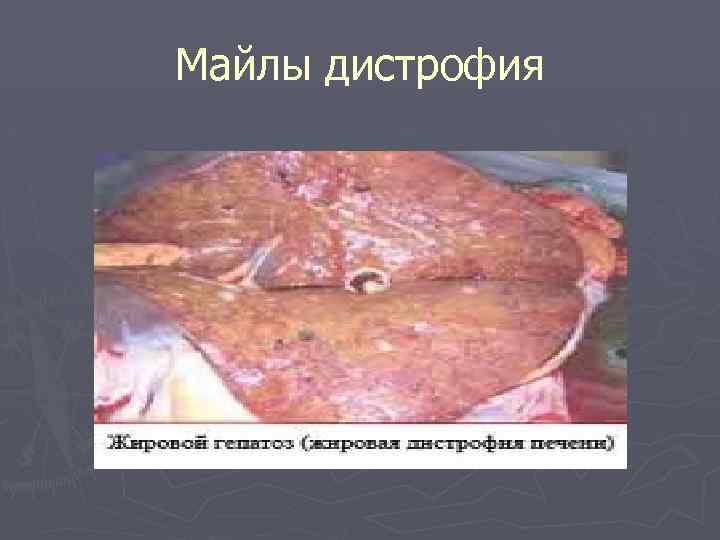 Майлы дистрофия 