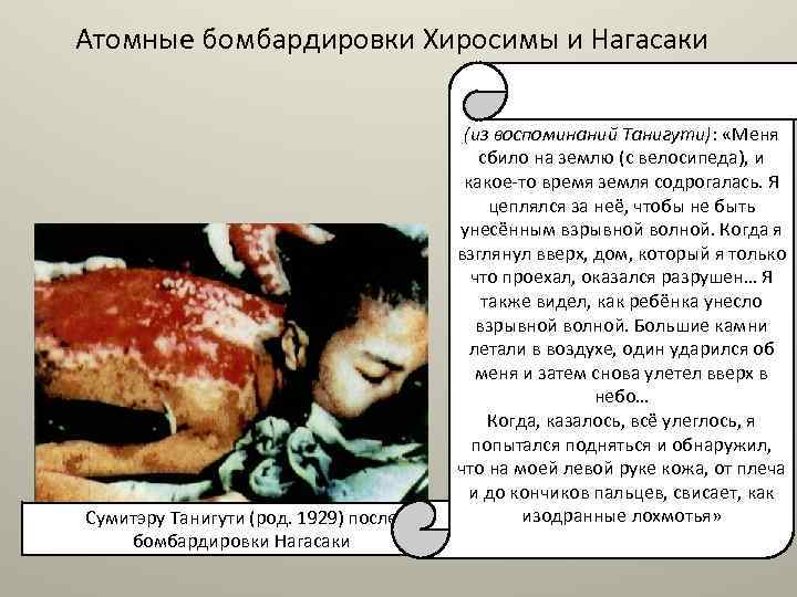 Атомные бомбардировки Хиросимы и Нагасаки Сумитэру Танигути (род. 1929) после бомбардировки Нагасаки (из воспоминаний