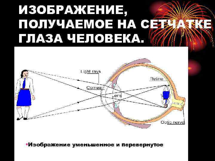 Какое изображение предметов образуется на сетчатке глаза человека