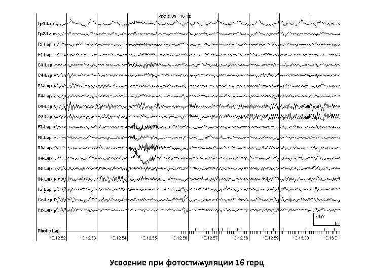 Усвоение при фотостимуляции 16 герц 