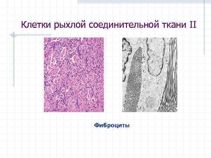 Клетки рыхлой соединительной ткани II Фиброциты 