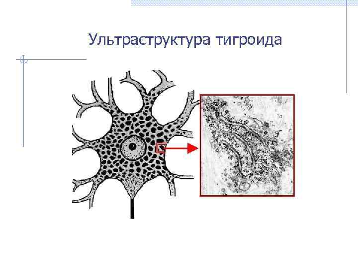 Ультраструктура тигроида 