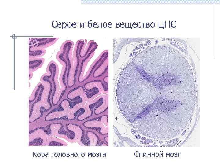 Серое и белое вещество ЦНС Кора головного мозга Спинной мозг 