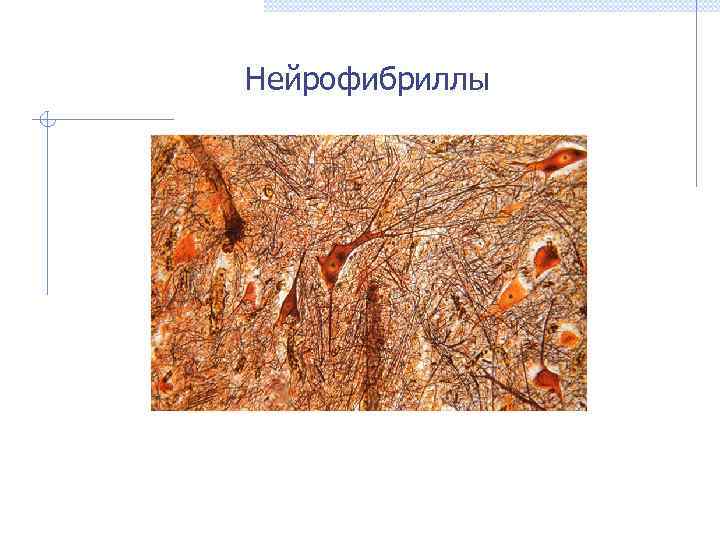 Нейрофибриллы 