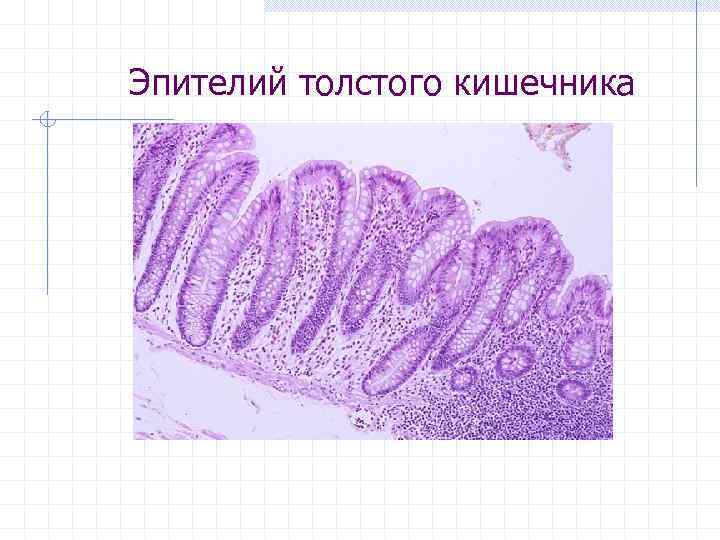 Эпителий толстого кишечника 