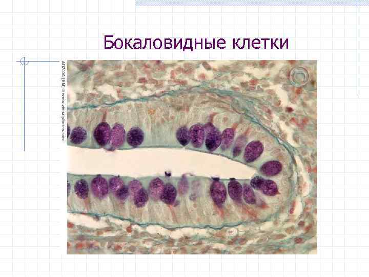 Бокаловидные клетки 