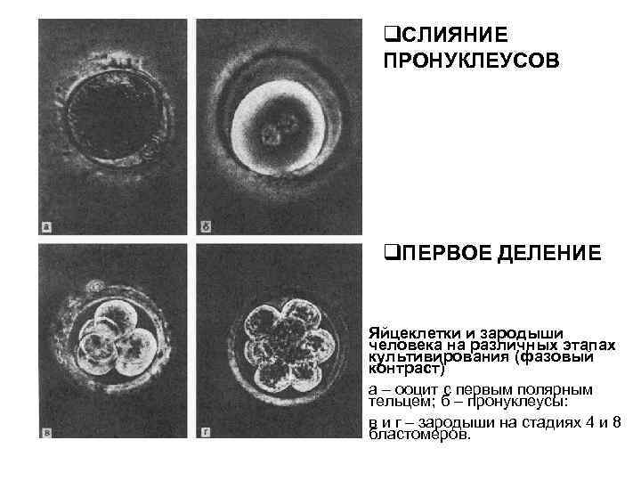 Ооциты деление. Эмбрион с 1 пронуклеусом. Пронуклеус зиготы. Пронуклеус яйцеклетки. Зигота человека с пронуклеусами.