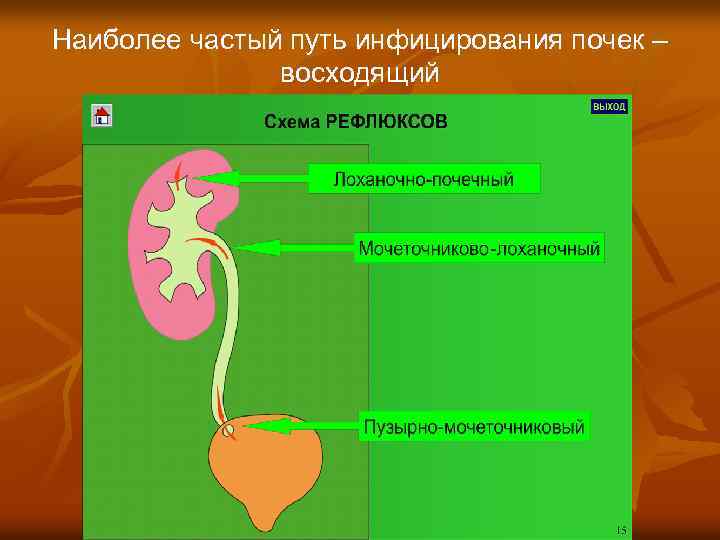 Наиболее частый путь инфицирования почек – восходящий 