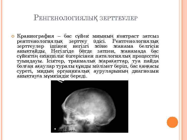РЕНГЕНОЛОГИЯЛЫҚ ЗЕРТТЕУЛЕР Краниография – бас сүйек миының контраст затсыз рентгенологиялық зерттеу әдісі. Рентгенологиялық зерттеулер
