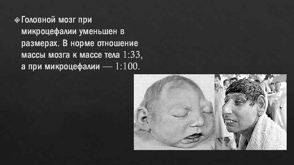  Головной мозг при микроцефалии уменьшен в размерах. В норме отношение массы мозга к