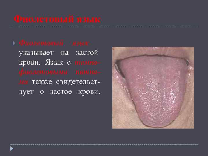 Заболевания языка фото и описания