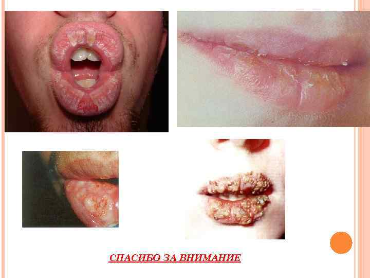 СПАСИБО ЗА ВНИМАНИЕ 