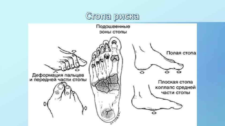 Стопа риска 