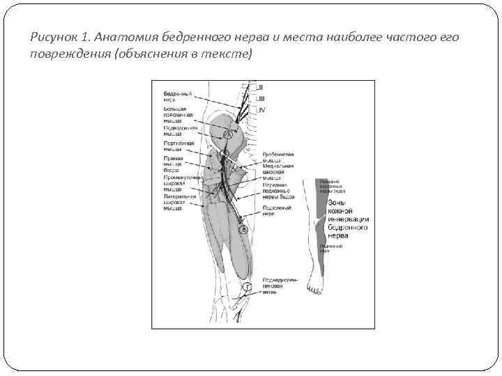Невропатия малоберцового нерва мкб 10