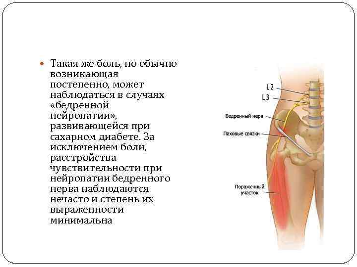  Такая же боль, но обычно возникающая постепенно, может наблюдаться в случаях «бедренной нейропатии»