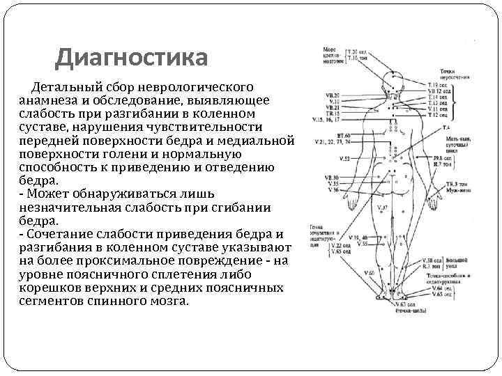 Диагностика Детальный сбор неврологического анамнеза и обследование, выявляющее слабость при разгибании в коленном суставе,