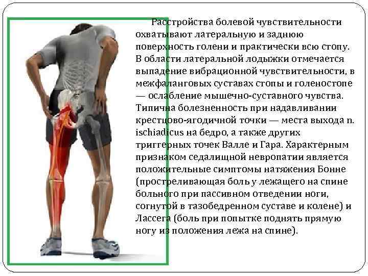  Расстройства болевой чувствительности охватывают латеральную и заднюю поверхность голени и практически всю стопу.