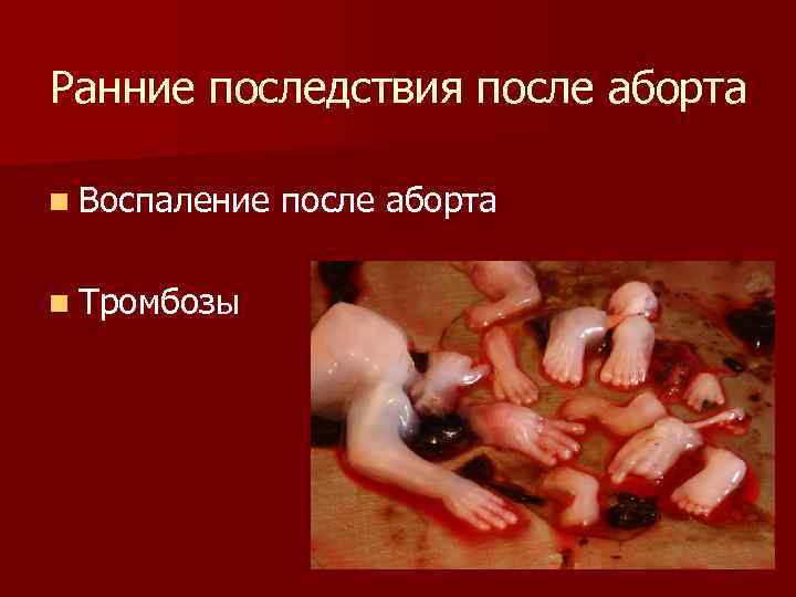 Ранние последствия после аборта n Воспаление n Тромбозы после аборта 