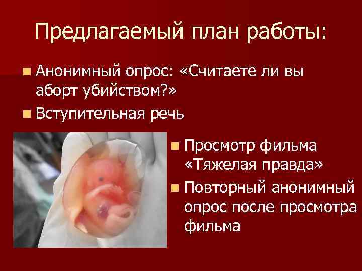 Предлагаемый план работы: n Анонимный опрос: «Считаете ли вы аборт убийством? » n Вступительная