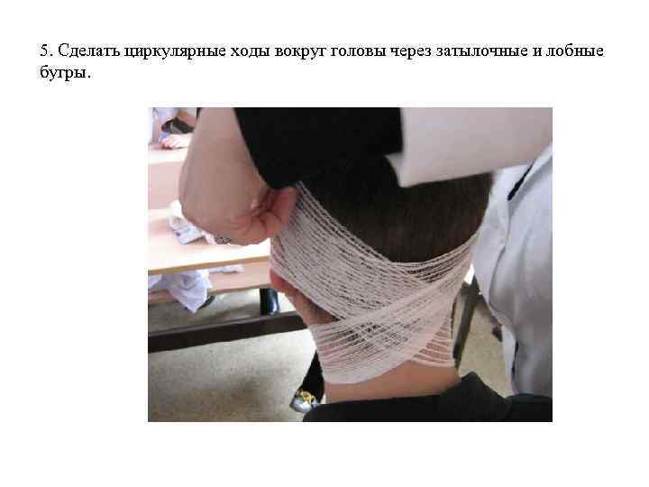 5. Сделать циркулярные ходы вокруг головы через затылочные и лобные бугры. 