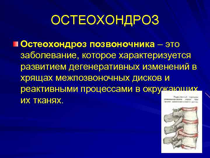 ОСТЕОХОНДРОЗ Остеохондроз позвоночника – это заболевание, которое характеризуется развитием дегенеративных изменений в хрящах межпозвоночных