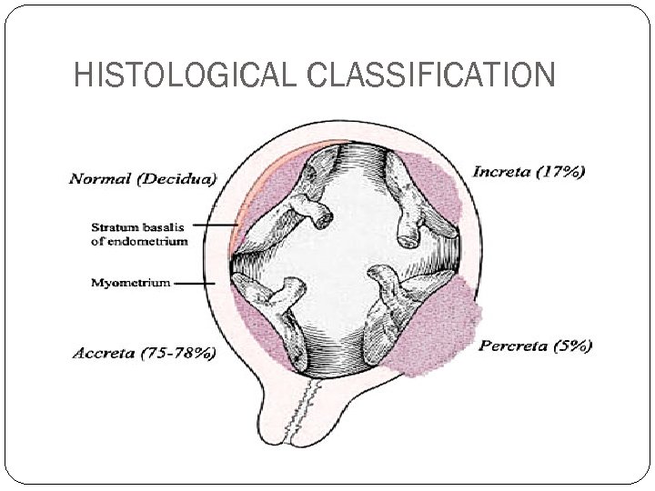 HISTOLOGICAL CLASSIFICATION 