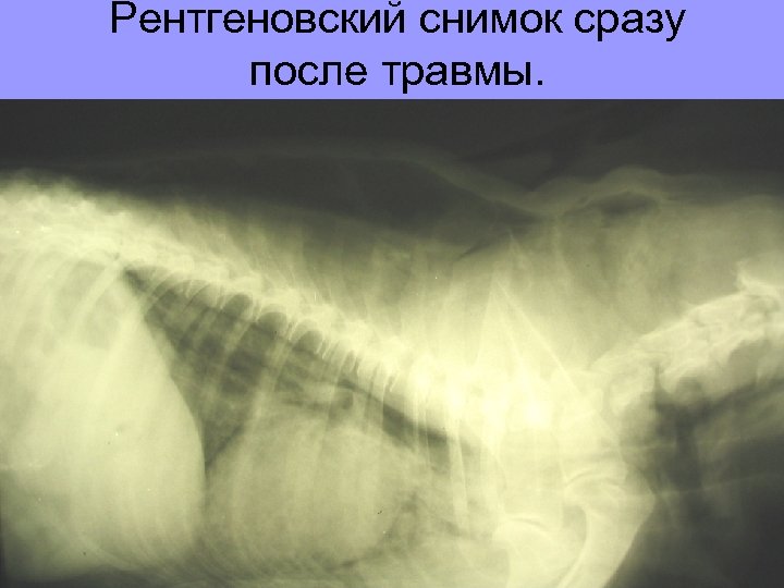 Рентгеновский снимок сразу после травмы. 