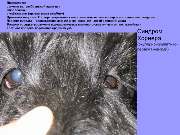 Проявляется сужение пальпебральной щели век миоз зрачка, энофтальмия (провал глаза в орбиту) Причины синдрома