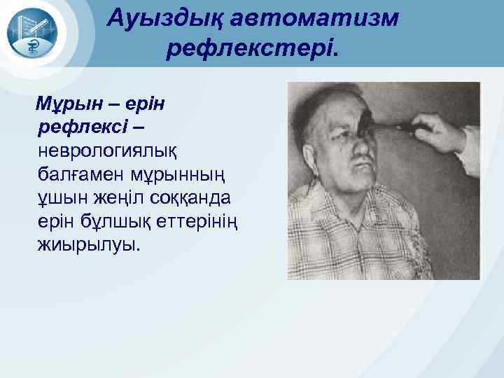 Ауыздық автоматизм рефлекстері. Мұрын – ерін рефлексі – неврологиялық балғамен мұрынның ұшын жеңіл соққанда