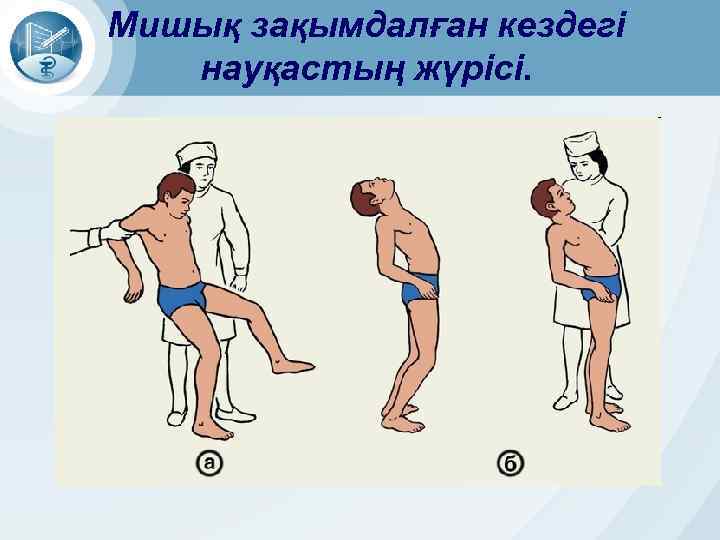 Мишық зақымдалған кездегі науқастың жүрісі. 