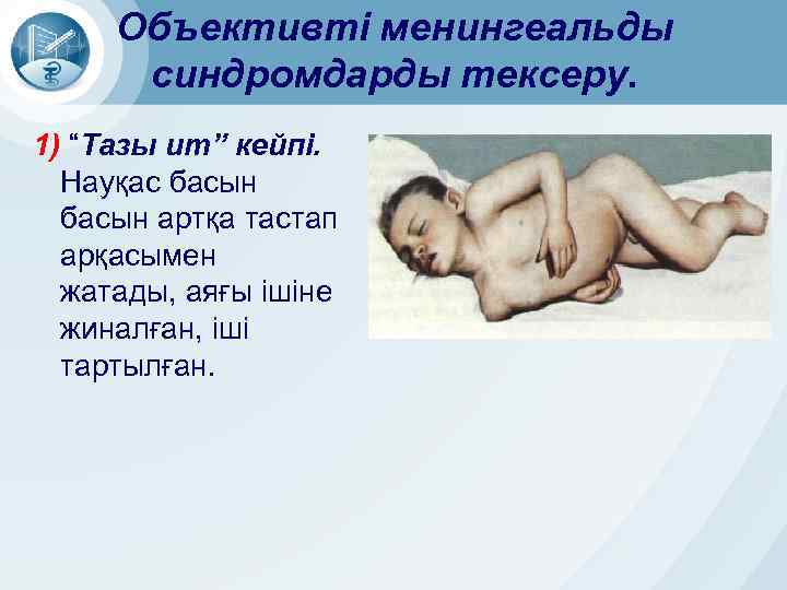 Объективті менингеальды синдромдарды тексеру. 1) “Тазы ит” кейпі. Науқас басын артқа тастап арқасымен жатады,