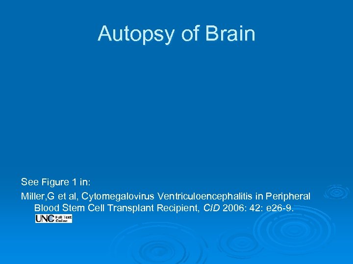 Autopsy of Brain See Figure 1 in: Miller, G et al, Cytomegalovirus Ventriculoencephalitis in