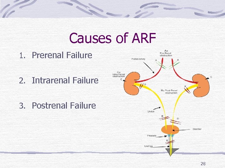 Causes of ARF 1. Prerenal Failure 2. Intrarenal Failure 3. Postrenal Failure 28 