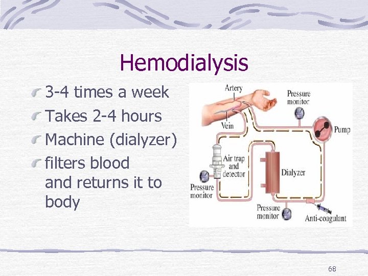 Hemodialysis 3 -4 times a week Takes 2 -4 hours Machine (dialyzer) filters blood
