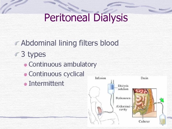 Peritoneal Dialysis Abdominal lining filters blood 3 types Continuous ambulatory Continuous cyclical Intermittent 74